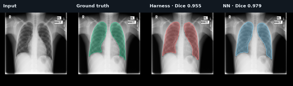 CXR lower quartile case: input, ground truth, Harness, and fixed NN ensemble