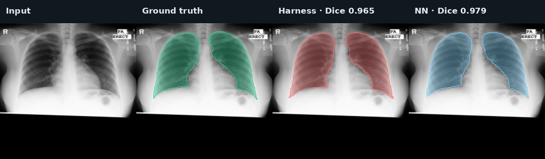 CXR median case: input, ground truth, Harness, and fixed NN ensemble
