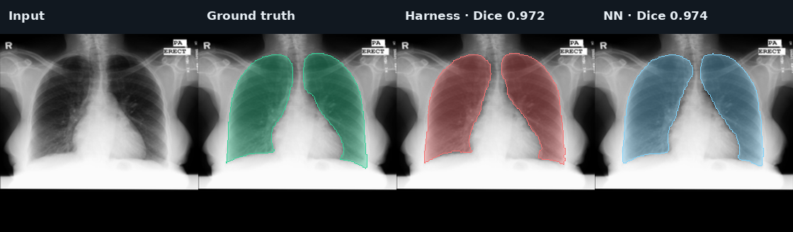 CXR upper quartile case: input, ground truth, Harness, and fixed NN ensemble