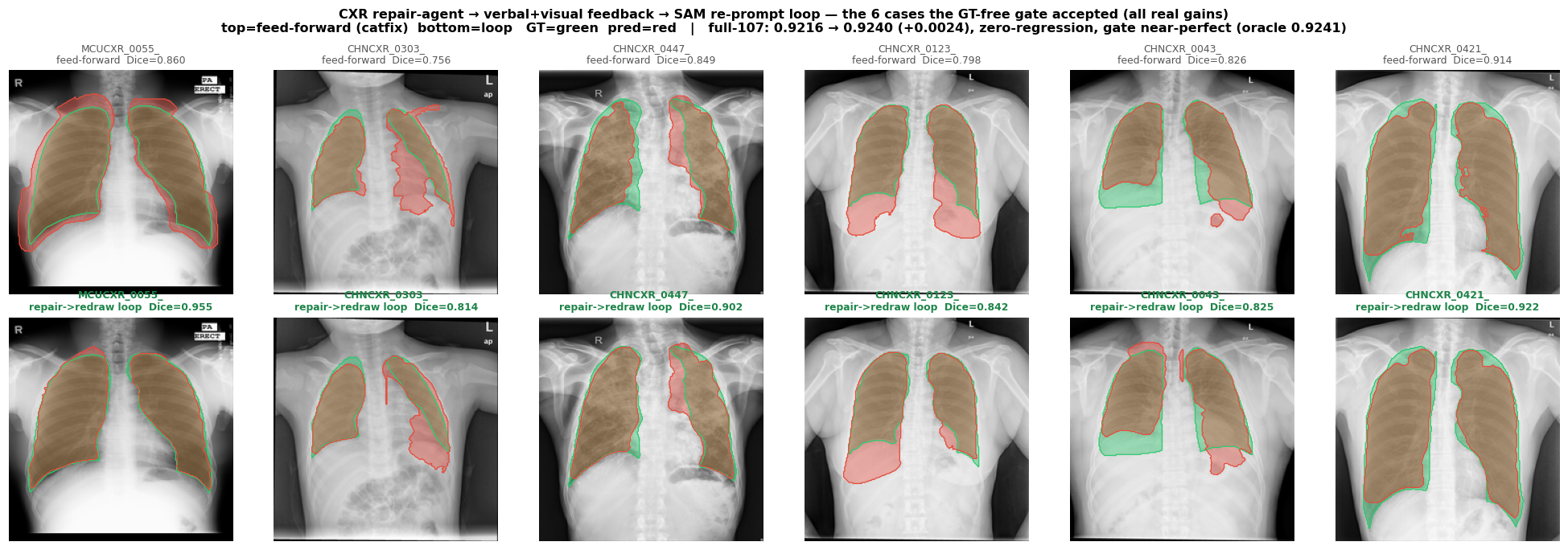 CXR loop vs feed-forward