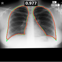 Test image MCUCXR_0029_0, Dice 0.977