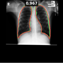Test image MCUCXR_0042_0, Dice 0.967