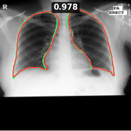 Test image MCUCXR_0058_0, Dice 0.978