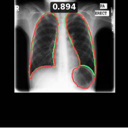 Test image MCUCXR_0077_0, Dice 0.894