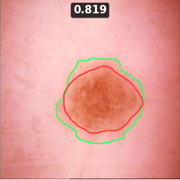 ISIC_0016344 Dice 0.819