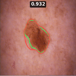Test image ISIC_0019030, Dice 0.932