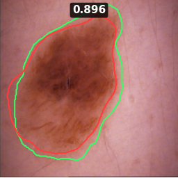 Test image ISIC_0019143, Dice 0.896