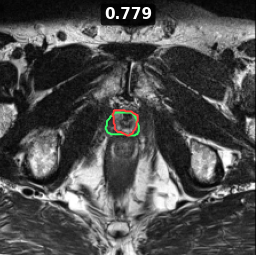 Test image prostate_07_z011, Dice 0.779