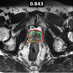 Test image prostate_07_z013, Dice 0.843